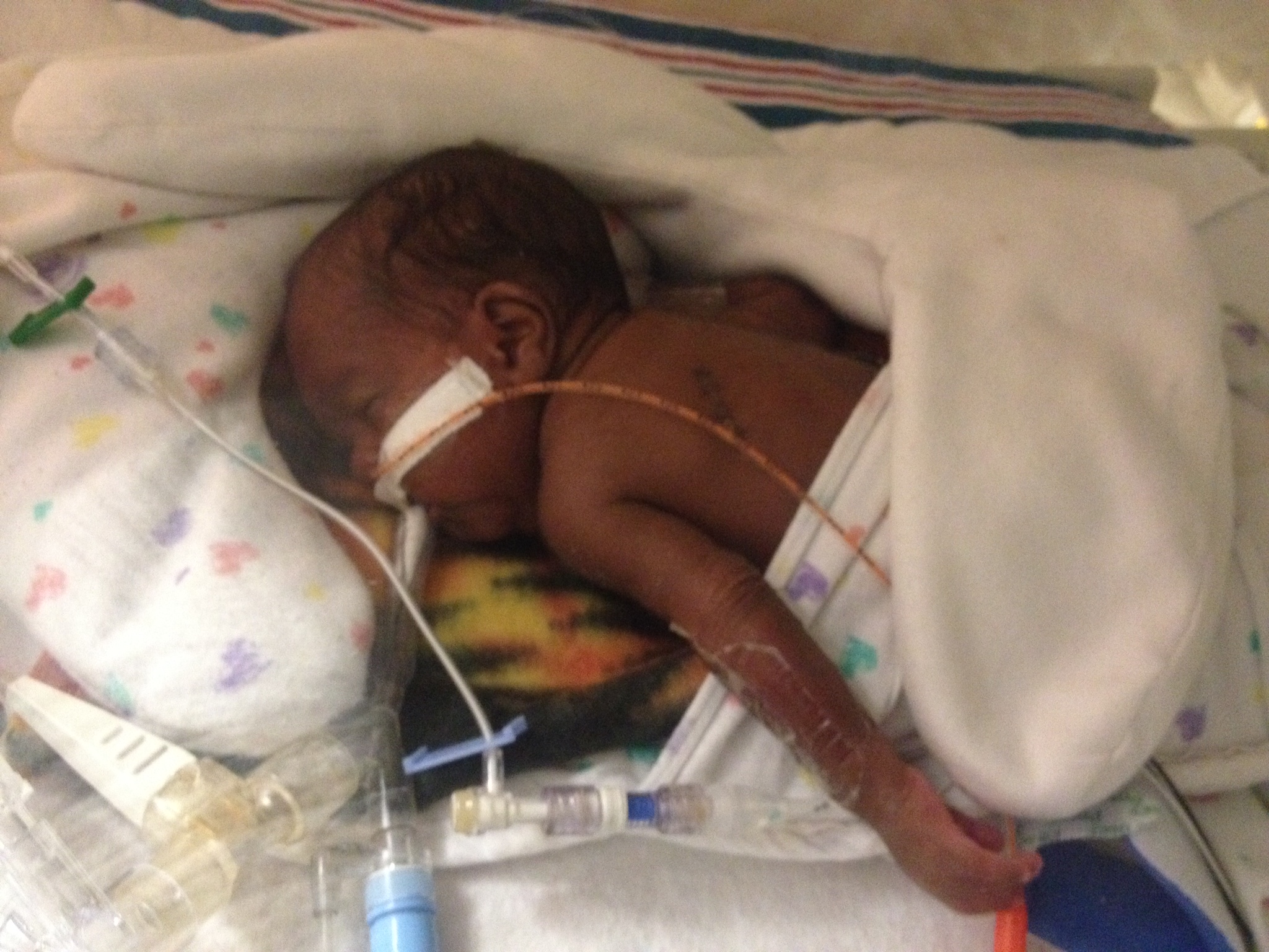 Premature infant in NICU

T. Leverett 2013